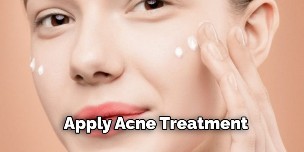 Apply Acne Treatment