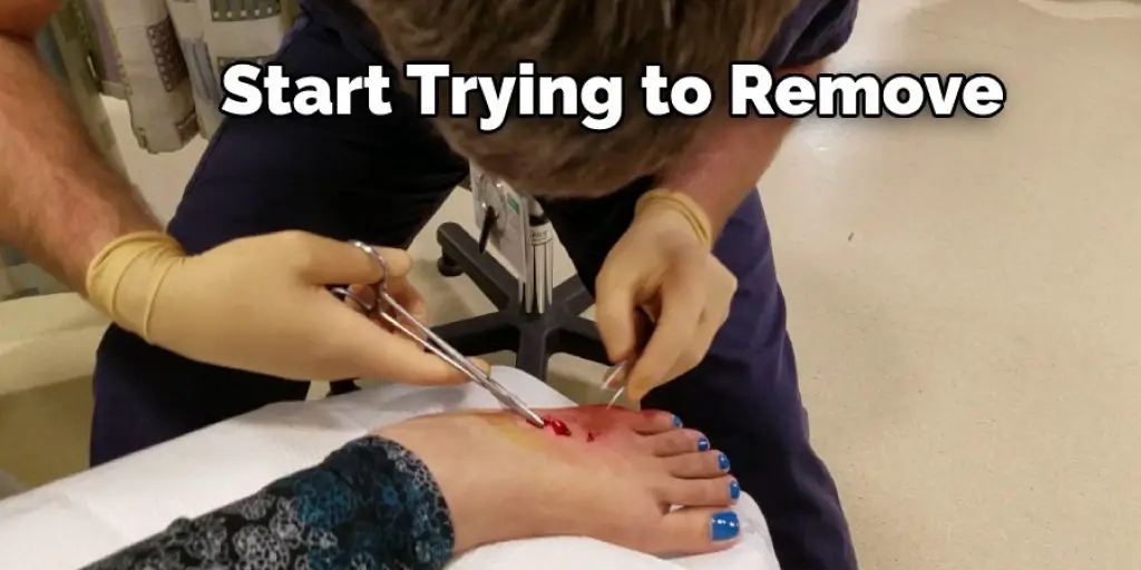Start Trying to Remove